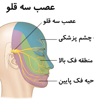 نورالژی عصب سه قلو
